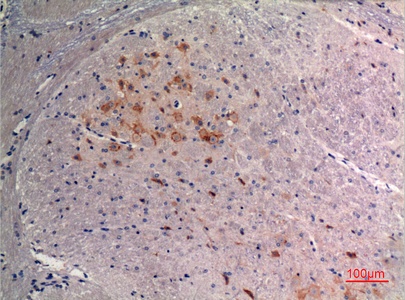 Fig.3. Immunohistochemical analysis of paraffin-embedded Mouse-brain, antibody was diluted at 1:100.