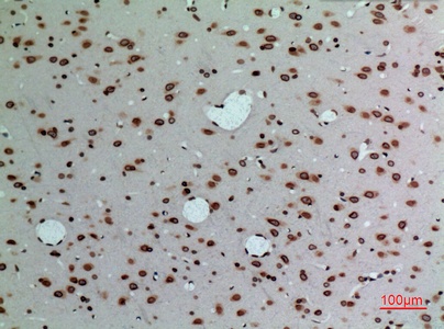 Fig.2. Immunohistochemical analysis of paraffin-embedded rat-brain, antibody was diluted at 1:100.