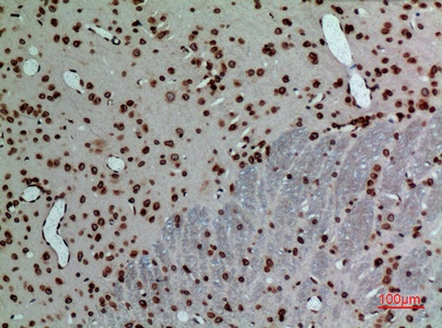 Fig.3. Immunohistochemical analysis of paraffin-embedded rat-brain, antibody was diluted at 1:100.