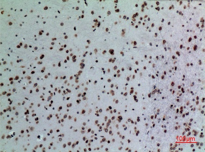 Fig.5. Immunohistochemical analysis of paraffin-embedded Mouse-brain, antibody was diluted at 1:100.