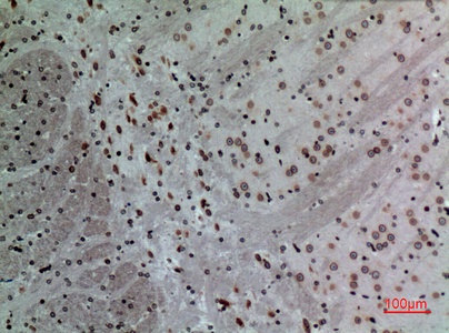 Fig.6. Immunohistochemical analysis of paraffin-embedded Mouse-brain, antibody was diluted at 1:100.