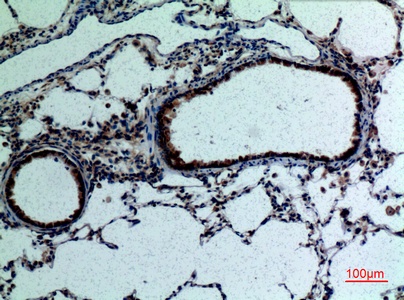 Fig.2. Immunohistochemical analysis of paraffin-embedded rat-lung, antibody was diluted at 1:100.