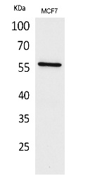 Fig.1. Western Blot analysis of MCF7 cells using ALK-1 Polyclonal Antibody. Secondary antibody (catalog#: A21020) was diluted at 1:20000.