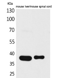 Fig.1. Western Blot analysis of Mouse liver, Mouse spinal cord cells using Aldolase C Polyclonal Antibody. Secondary antibody (catalog#: A21020) was diluted at 1:20000.