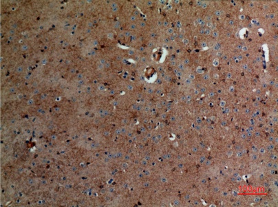Fig.5. Immunohistochemical analysis of paraffin-embedded Mouse-brain, antibody was diluted at 1:100.