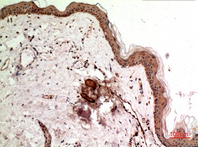 Fig.2. Immunohistochemical analysis of paraffin-embedded human-skin, antibody was diluted at 1:100.