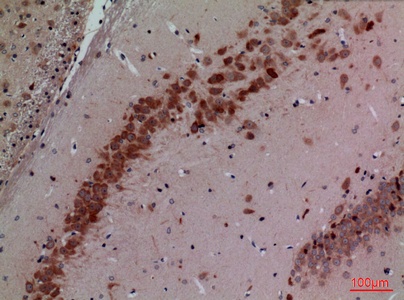 Fig.2. Immunohistochemical analysis of paraffin-embedded rat-brain, antibody was diluted at 1:100.