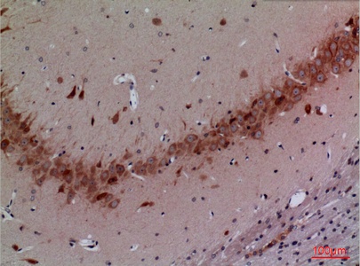 Fig.3. Immunohistochemical analysis of paraffin-embedded rat-brain, antibody was diluted at 1:100.