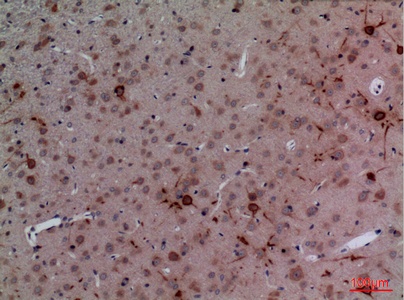 Fig.4. Immunohistochemical analysis of paraffin-embedded rat-brain, antibody was diluted at 1:100.