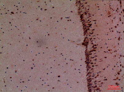 Fig.5. Immunohistochemical analysis of paraffin-embedded Mouse-brain, antibody was diluted at 1:100.