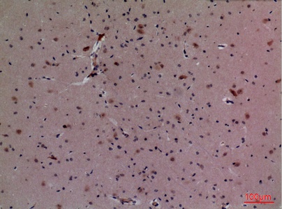 Fig.6. Immunohistochemical analysis of paraffin-embedded Mouse-brain, antibody was diluted at 1:100.