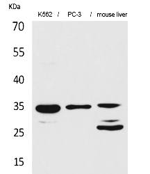 Fig.1. Western Blot analysis of K562,  PC-3, Mouse liver cells using Cdc34 Polyclonal Antibody. Secondary antibody (catalog#: A21020) was diluted at 1:20000.