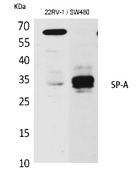 Fig.1. Western Blot analysis of K562,  Mouse lung cells using SP-A Polyclonal Antibody. Secondary antibody (catalog#: A21020) was diluted at 1:20000.