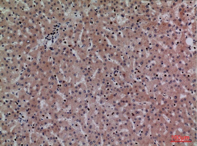 Fig.2. Immunohistochemical analysis of paraffin-embedded human-liver, antibody was diluted at 1:100.