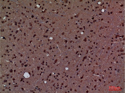Fig.3. Immunohistochemical analysis of paraffin-embedded rat-brain, antibody was diluted at 1:100.