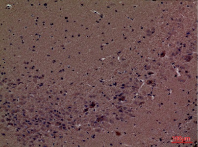 Fig.6. Immunohistochemical analysis of paraffin-embedded Mouse-brain, antibody was diluted at 1:100.