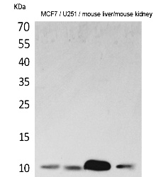 Fig. Western Blot analysis of MCF7, U251,  Mouse liver, Mouse kidney cells using ACBP Polyclonal Antibody. Secondary antibody (catalog#: A21020) was diluted at 1:20000.