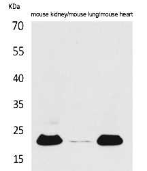Fig.1. Western Blot analysis of Mouse kidney, Mouse lung, Mouse heart cells using ADM Polyclonal Antibody. Secondary antibody (catalog#: A21020) was diluted at 1:20000.