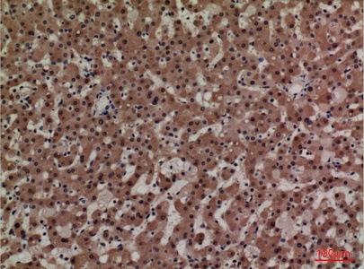 Fig.2. Immunohistochemical analysis of paraffin-embedded human-liver, antibody was diluted at 1:100.