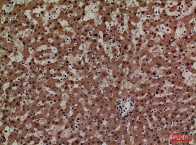 Fig.3. Immunohistochemical analysis of paraffin-embedded human-liver, antibody was diluted at 1:100.