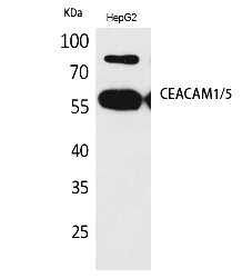 Fig.1. Western Blot analysis of HepG2 cells using CEACAM1/5 Polyclonal Antibody. Antibody was diluted at 1:1000. Secondary antibody (catalog#: A21020) was diluted at 1:20000.