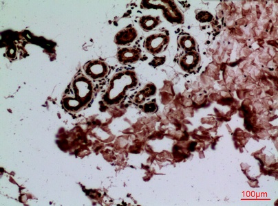 Fig.2. Immunohistochemical analysis of paraffin-embedded human-skin, antibody was diluted at 1:100.
