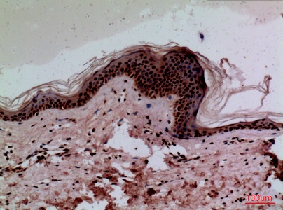 Fig.3. Immunohistochemical analysis of paraffin-embedded human-skin, antibody was diluted at 1:100.