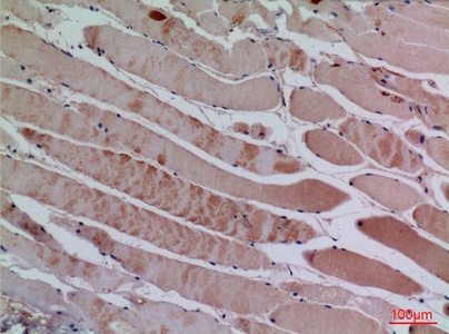 Fig.2. Immunohistochemical analysis of paraffin-embedded human-muscle, antibody was diluted at 1:100.
