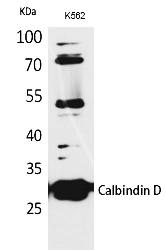 Fig.1. Western Blot analysis of K562 cells using Calbindin D28K Polyclonal Antibody. Antibody was diluted at 1:1000. Secondary antibody (catalog#: A21020) was diluted at 1:20000.