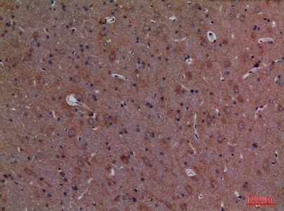 Fig.2. Immunohistochemical analysis of paraffin-embedded rat-brain, antibody was diluted at 1:100.