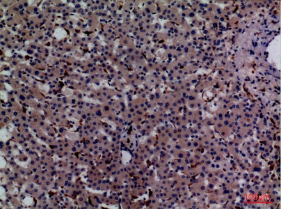 Fig.4. Immunohistochemical analysis of paraffin-embedded human-liver, antibody was diluted at 1:100.