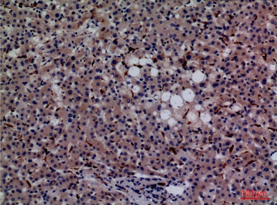 Fig.5. Immunohistochemical analysis of paraffin-embedded human-liver, antibody was diluted at 1:100.