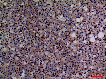 Fig.6. Immunohistochemical analysis of paraffin-embedded human-liver, antibody was diluted at 1:100.