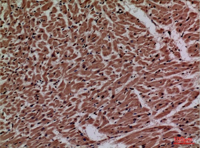 Fig.2. Immunohistochemical analysis of paraffin-embedded human-heart, antibody was diluted at 1:100.
