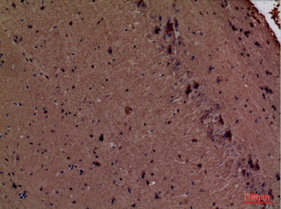 Fig.3. Immunohistochemical analysis of paraffin-embedded Mouse-brain, antibody was diluted at 1:100.