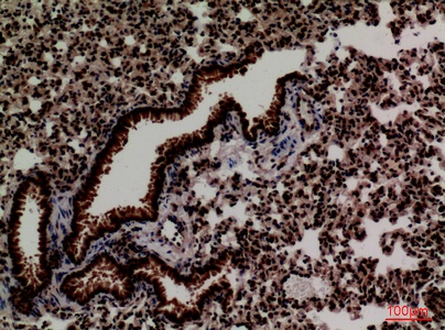 Fig.3. Immunohistochemical analysis of paraffin-embedded Mouse-lung, antibody was diluted at 1:100.