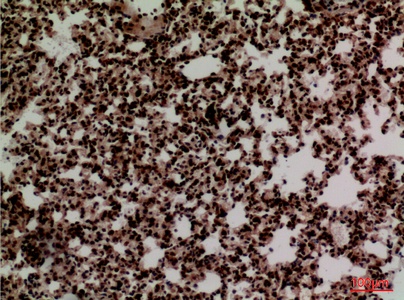 Fig.4. Immunohistochemical analysis of paraffin-embedded Mouse-lung, antibody was diluted at 1:100.