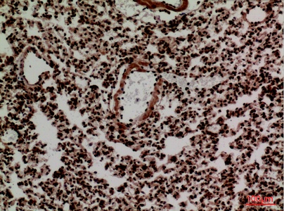 Fig.5. Immunohistochemical analysis of paraffin-embedded Mouse-lung, antibody was diluted at 1:100.