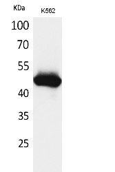 Fig. Western Blot analysis of K562 cells using IL-5Rα Polyclonal Antibody. Secondary antibody (catalog#: A21020) was diluted at 1:20000.