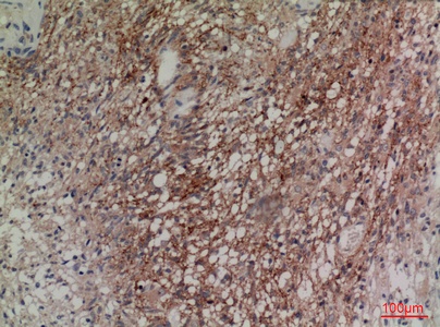 Fig.2. Immunohistochemical analysis of paraffin-embedded human-brain, antibody was diluted at 1:100.