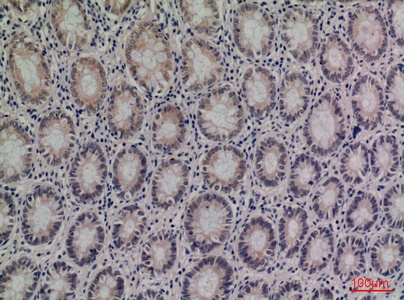 Fig.2. Immunohistochemical analysis of paraffin-embedded human-colon, antibody was diluted at 1:100.