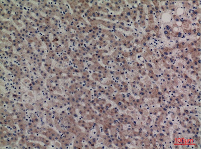 Fig.3. Immunohistochemical analysis of paraffin-embedded human-liver, antibody was diluted at 1:100.