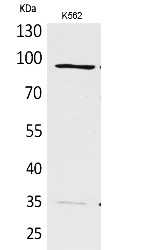 Fig.1. Western Blot analysis of K562 cells using MCM3 Polyclonal Antibody. Secondary antibody (catalog#: A21020) was diluted at 1:20000.