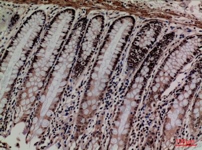 Fig.4. Immunohistochemical analysis of paraffin-embedded human-colon, antibody was diluted at 1:100.