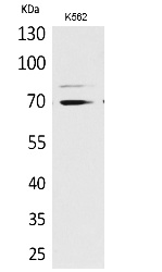 Fig.1. Western Blot analysis of K562 cells using Keap1 Polyclonal Antibody. Antibody was diluted at 1:1000. Secondary antibody (catalog#: A21020) was diluted at 1:20000.