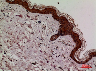 Fig.3. Immunohistochemical analysis of paraffin-embedded human-skin, antibody was diluted at 1:100.