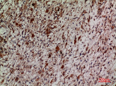 Fig.5. Immunohistochemical analysis of paraffin-embedded human-brain, antibody was diluted at 1:100.