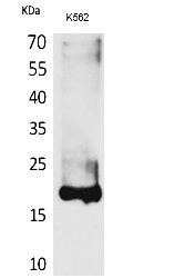 Fig.1. Western Blot analysis of K562 cells using Lipocalin-1 Polyclonal Antibody. Secondary antibody (catalog#: A21020) was diluted at 1:20000.