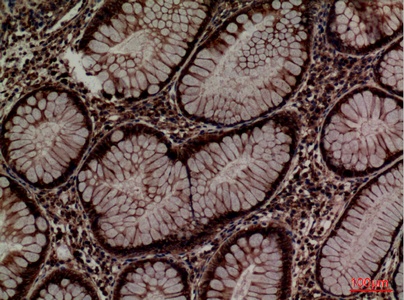 Fig.2. Immunohistochemical analysis of paraffin-embedded human-colon, antibody was diluted at 1:100.