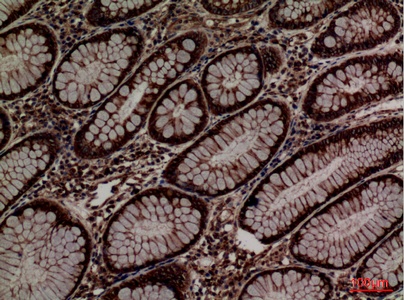 Fig.3. Immunohistochemical analysis of paraffin-embedded human-colon, antibody was diluted at 1:100.